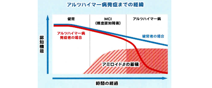 65際以上の5人に1人は認知症